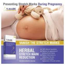 Retail Pharma India launches wide Range of V-Mark skin Product