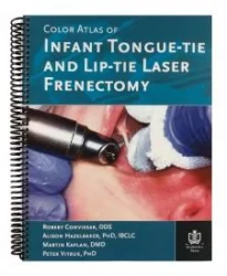 First of Its Kind Book About Infant Laser Frenectomies