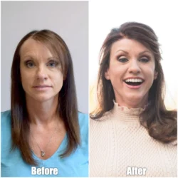 The Newest Hair Club® Atlanta Center is Designed Exclusively for Women Experiencing Hair Loss