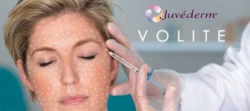 Juvederm and All Its Variants