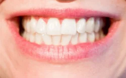 What Is Good Dental Care?