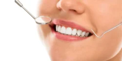 Why Are White Smiles So Attractive?