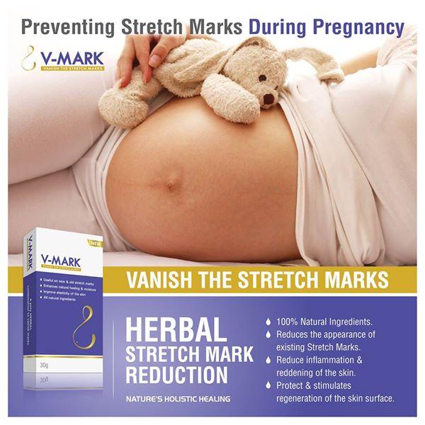 Retail Pharma India launches wide Range of V-Mark skin Product Retail Pharma India launches wide Range of V-Mark skin Product