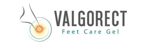 Valgorect As Alternative for treating bunions without surgery Valgorect As Alternative for treating bunions without surgery