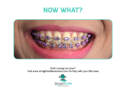 StraightSmile Solutions™- Orthodontic Consulting Launches Convenient, Digital, Hands-On Orthodontic Training and Consulting