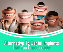 Alternative To Dental Implants That You Can Consider