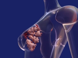 D. B. Ghosh Breast Clinic is Recognised for Top Breast Cancer Care